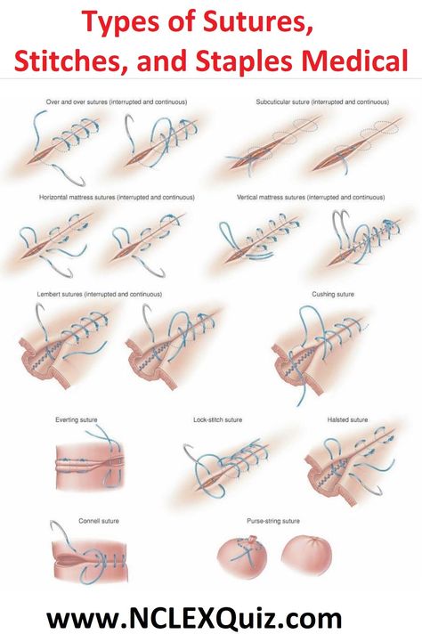 Suture Types, Surgical Suture, Vet Medicine, Medical Student Study, Surgical Tech, Nursing School Survival, Nursing School Studying, Medicine Student, Nursing School Tips