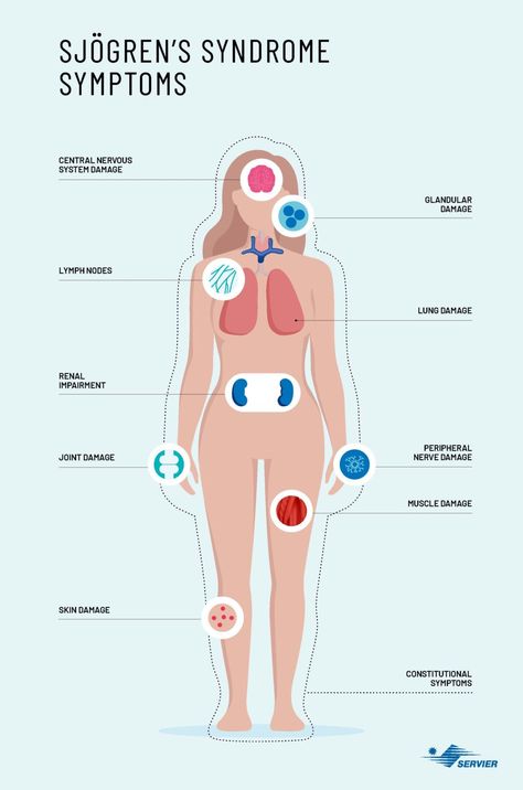 Sjögren’s Syndrome, Sjogrens Syndrome Symptoms, Sjogren Syndrome, Sjogrens Syndrome Diet, Osgood Schlatter Disease, Autoimmune Disease Symptoms, Autoimmune Disease Awareness, Dry Eye Symptoms, Fatigue Symptoms