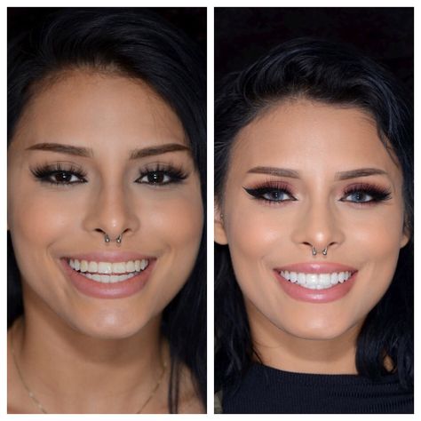 Things to know before you get veneers. Veneer Shapes Teeth, Celebrity Smiles Teeth, Beautiful Teeth Shape, Front Teeth Veneers Before And After, Hollywood Smile Veneers, Best Veneers Teeth, Pop On Veneers Before And After, Nice Teeth Smile Aesthetic, Teeth Implants Before And After