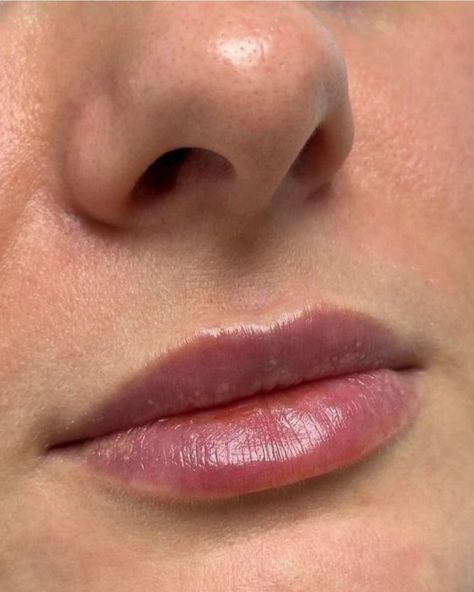 Rosy Lips Natural, Wide Lips Aesthetic, Small Lips Model, Downturned Lips, Small Lips Aesthetic, Round Lips, Thick Lips, Nose Jewels, Lip Pictures