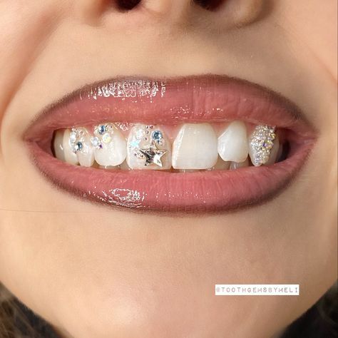 Confetti Tooth Gems, Y2k Teeth Gems, Heart Teeth Gem, Star Teeth Gem, Butterfly Teeth Gem, Disco Tooth Gem, Pretty Teeth, Dental Jewelry, Grillz Teeth