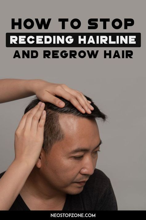 Are you concerned about your receding hairline and eager to regrow your hair? While it may require dedication and patience, there are effective strategies to help you combat hair loss and encourage new hair growth. Regrow Hairline, Men Hairline, Hairstyles For Receding Hairline, Regrow Hair Naturally, Receding Hair Styles, New Hair Do, Hairstyle For Men, How To Grow Your Hair Faster, Receding Hairline