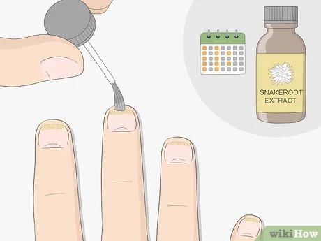 3 Ways to Get Rid of Nail Fungus - wikiHow Artery Cleanse, Sunburn Peeling, Toenail Fungal Infection, Nail Remedies, Fingernail Fungus, Red Hair Trends, Nail Infection, Nail Fungus Remedy, Fungal Nail