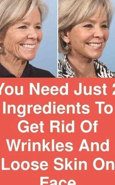 Wrinkles Remedies Face, Oily Skincare, Get Rid Of Wrinkles, Wrinkle Remedies, Routine Skincare, Skin Care Wrinkles, Face Wrinkles, Remove Acne, Loose Skin