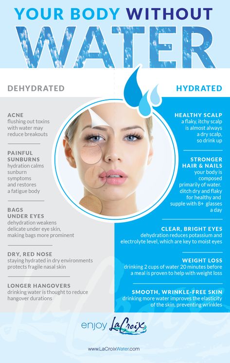 Your Body Without Water! Water Health Benefits, Benefits Of Drinking Water, Not Drinking Enough Water, Kangen Water, Water Benefits, Wrinkle Reduction, Healthy Diet Tips, Daily Health Tips, Fitness Advice