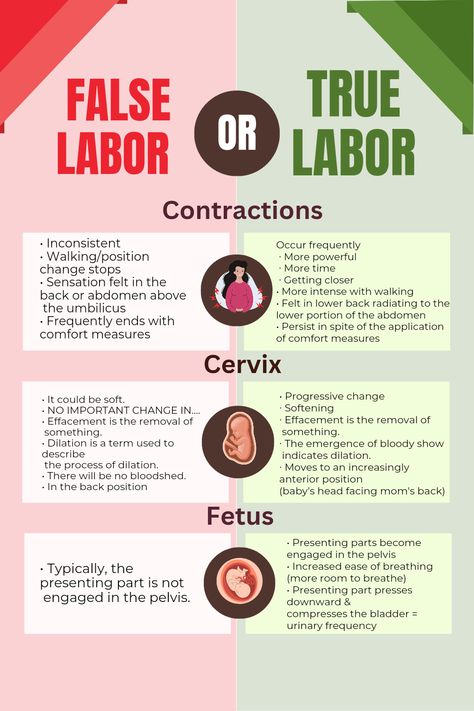 Understanding False vs True Labor: What You Need to Know Nursing School Labor And Delivery, Labor And Delivery Nursing School Notes, Midwifery Nursing Notes, Labor And Delivery Notes, Labor And Delivery Cheat Sheets, Labor And Delivery Nursing School, Tips For Labor And Delivery, Midwife Study Notes, Obgyn Nursing Notes