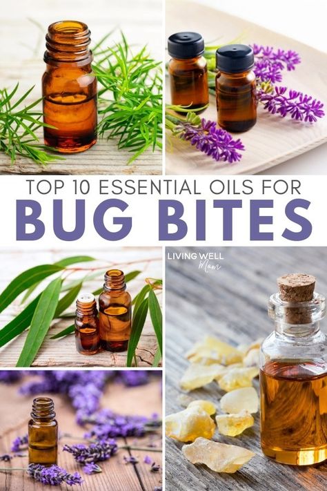 The 10 best essential oils for bug bites for soothing and relieving itchy mosquito, gnats, flies, and other irritating insect bites. Plus an easy DY essential oil roller blend recipe using lavender, tea tree, and other essential oils #rollerblend #bugbites #essentialoils Essential Oils For Bug Bites, Oils For Bug Bites, Essential Oils Bug Bites, Essential Oils For Mosquitoes, Mosquito Bite Relief, Itchy Bug Bites, Remedies For Mosquito Bites, Bug Bites Remedies, Bug Bite Relief