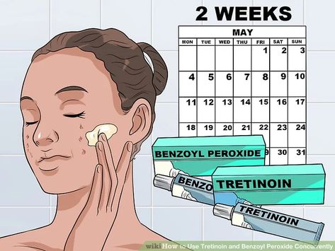 Treat Acne, Benzoyl Peroxide, 12 Steps, How To Treat Acne, Retinol, Toner, How To Use, Serum, Acne