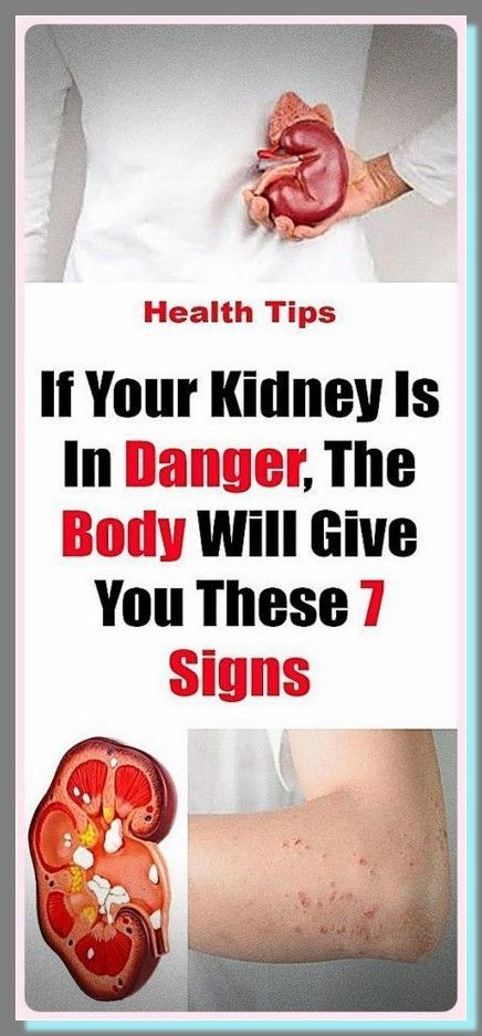 If Your Kidney Is in Danger, the Body Will Give You These 7 Signs! Kidney Damage, Kidney Health, What Happened To You, Healthy Living Tips, Healthy Tips, Holistic Health, Healthy Habits, Home Remedies, Baking Soda