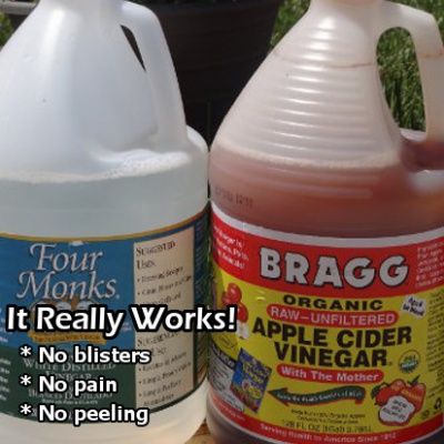 Apple Cider Vinegar, Uses For Vinegar, Heal Sunburn, Vinegar Uses, Magic Garden, Natural Tan, Veggie Garden, Cider Vinegar, Lawn And Garden