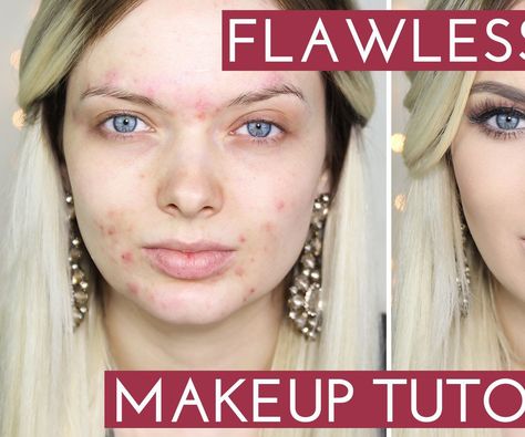 Makeup Tutorial - How To Apply HD Foundation Acne Coverage Makeup, Flawless Makeup Tutorial, Acne Coverage, Flawless Face Makeup, Acne Makeup, Foundation Routine, Best Makeup Tutorials, Makeup Tutorial Foundation, Make Up Tutorials