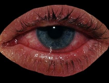 Crying Eyes, Scene Girl, Aesthetic Eyes, Lip Fillers, Eye Art, Pretty Eyes, Photo Reference, An Eye, Art Drawings Sketches