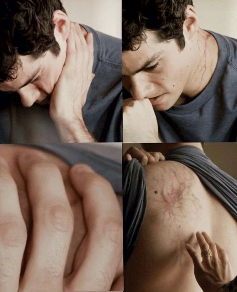 Dylan O'Brien as Stiles Stilinski #TeenWolf #VOID Stiles #Nogitsune #Stiles Stilinski #mieczyslaw stilinski #SaveTeenWolf Stiles Stilinski Tattoo, Stiles Stilinski Tattoo Ideas, Stiles Stilinski Outfits, Stiles Stilinski Fanart, Stiles Stilinski Void, Stiles Stilinski Aesthetic, Stiles Stilinski Imagines, Teen Wolf Tattoo, Wolf Aesthetic