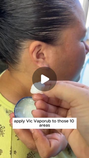 Vapor Rub Uses, Vic Vaporub, Earache Remedies, Vapo Rub, Vicks Vapor Rub, Vicks Vapor, Vicks Vaporub Uses, Uses For Vicks, Sinus Relief