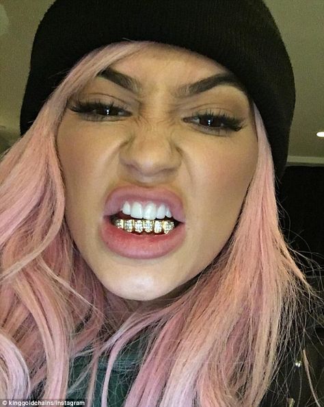 Diamonds are forever: Kylie Jenner showed off a new diamond-encrusted grill in Tyga's Instagram photo on Monday Unique Tooth Gems, Kylie Jenner Pink Hair, Girls With Grills, Girl Grillz, Grillz Teeth, Diamond Grillz, Gold Grill, Looks Kylie Jenner, Grills Teeth