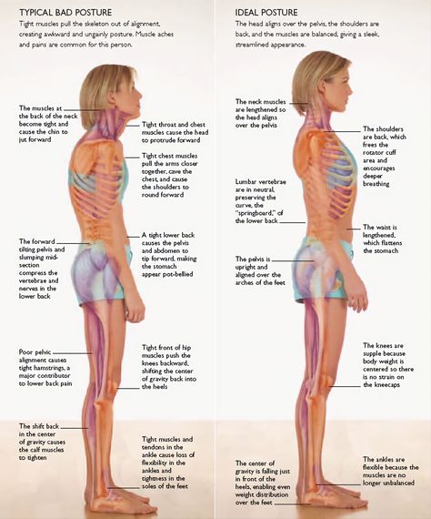 Posture Fix, Bolesti Chrbta, Posture Exercises, Coconut Health Benefits, Bad Posture, Poor Posture, Posture Correction, Muscle Aches, Hip Flexor