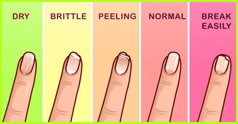 Jealous of your friends having gorgeous long fingernails? Take these 5 foods and follow these methods to make your nails grow faster and stronger naturally. Grow Nails Faster, Long Fingernails, How To Grow Nails, Nail Growth, Strong Nails, Nail Health, Womens Nails, Yellow Nails, Healthy Nails