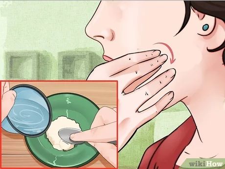 4 Ways to Remove Ingrown Hair on Your Face - wikiHow Ingrown Facial Hair Women, Ingrown Chin Hair Women, Remove Ingrown Hair, Infected Ingrown Hair, Treat Ingrown Hair, Female Facial Hair, Ingrown Hair Remedies, Bump Hairstyles, Ingrown Hair Removal