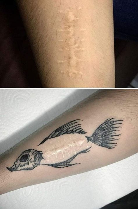 Tattoo ideas Tattoo Over Scar, Scar Cover Up, Tattoos To Cover Scars, Body Positivity Art, Scar Tattoo, Tatuaje A Color, 3d Tattoo, Hand Tattoos For Guys, Cover Up Tattoo