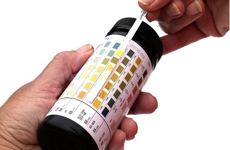 How to perform a urinalysis. Certified Medical Assistant, Nursing Assessment, Medical Laboratory Science, Medical Laboratory, Medical Assistant, Medical Education, Anatomy And Physiology, Health Facts, Medical Professionals