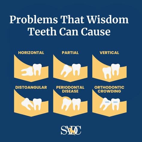 Surgical Assistant, Dental Images, Dental Tips, Dental Fun, Wisdom Teeth Removal, Dental Facts, Tooth Pain, Wisdom Teeth, New Inventions