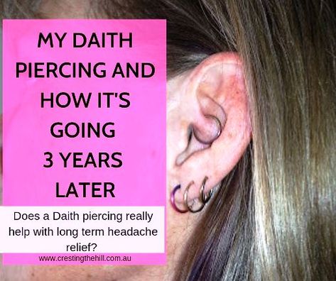 There's no scientific proof that a daith piercing works to relieve migraines and chronic headache. I've had mine for three years and this is how mine has impacted on my headaches. #daith #piercing #headaches #migraines Ear Piercing For Headaches, Ear Piercing For Migraines, Piercing For Migraine Relief, Daith Piercing Migraine, Kylie Jenner Ear Piercings, Hormonal Headaches, Migraine Piercing, Inner Ear Piercing, How To Relieve Migraines