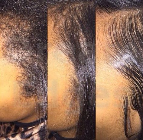 4 Tips To Make Your Edge Control More Effective Edge Control, Pelo Afro, Black Hair Care, Natural Hair Tips, Natural Hair Journey, Relaxed Hair, Hair Gel, Hair Journey, Hair Care Tips