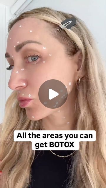 Face Botox Areas, Nose Tip Lift Botox Before And After, Botox Eye Lift, Botox For Downturned Mouth, Botox For Jawline, Neck Botox Before And After, Botox For Hooded Eyelids, Botox Jawline Before And After, Botox Eyes