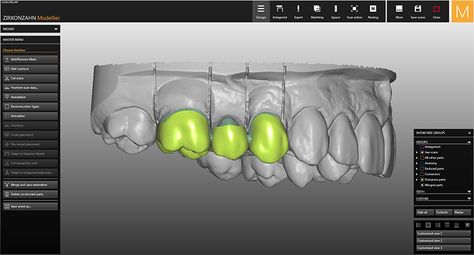 Collage, Software, Dental Lab, Cad Cam, Rock Metal, Lab, Pins, Quick Saves