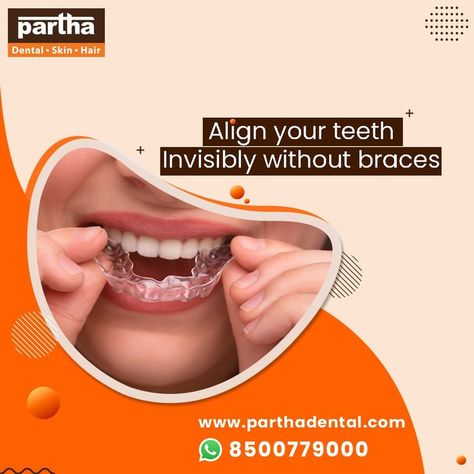 Dental Aligners, Invisible Teeth Braces, Invisible Aligners, Dental Advertising, Invisalign Aligners, Teeth Alignment, Dental Posts, Dental Posters, Invisible Braces