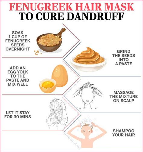 Home Remedies For Dandruff And Itchy Scalp | Femina.in Diy Hair Mask For Dandruff, Fenugreek For Hair, Natural Dandruff Remedy, Hair Mask For Dandruff, Home Remedies For Dandruff, Dandruff Remedy, Hair Care Recipes, Hair Dandruff, Hair Masks