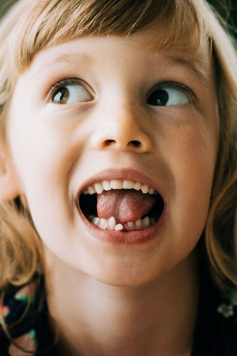 What Do I Do If My Kid Swallowed a Baby Tooth? Child Aesthetic, Kids Cough, Chipped Tooth, Dental Aesthetics, Dental Photography, Kids Dentist, Kids Teeth, Loose Tooth, Tooth Removal