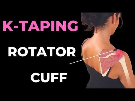 How to treat Shoulder pain - rotator cuff and bursitis with Kinesiology taping techniques - YouTube How To Kt Tape Your Shoulder, Rotator Cuff Taping, Shoulder Kinesio Taping, Rotator Cuff Kt Taping, Kt Tape Shoulder Rotator Cuff, How To Tape Shoulder For Pain, Shoulder Taping For Pain, Kinesiology Taping Shoulder, Kt Tape Shoulder