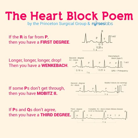 The Heart Block Poem  For more mnemonics, visit our site! http://nurseslabs.com Nursing Mnemonics, Cardiac Nursing, Nursing School Survival, Heart Blocks, Critical Care Nursing, Nursing School Studying, Nursing School Tips, Nursing School Notes, Nursing Tips