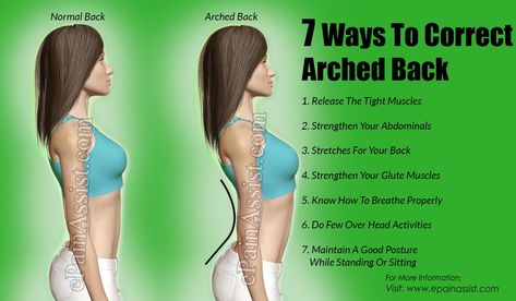 Stretches For Your Back, Fix Posture, Back Arch, Body Rock, Posture Correction, Good Posture, Back Exercises, Lower Back, Your Back