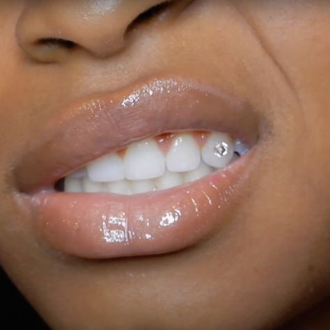 How To Do Tooth Gems At Home, Diamond On Tooth, Cute Tooth Gems, Basic Tooth Gem Ideas, Tooth Gem Prices, Piercing Dental, Teeth Gems Ideas, Tooth Gem Placement, Tooth Gem Kit