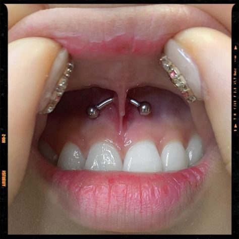 Smiley Piercing - Piercing Idea Smiley Piercing Jewelry, Cheeks Piercing, Smile Piercing, Gummy Smile, Piercing Inspo, Smiley Piercing, Jewelry Piercing, Airbrush App, Piercings Unique