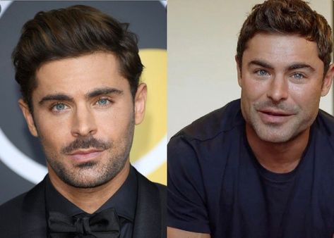 Zac Efron Plastic Surgery 2021, Zac Efron Before And After Surgery, Plastic Surgery Transformation, Zac Efron 2023, Zac Efron Plastic Surgery, Zac Efron Muscle, Dylan Efron, Zac Efron Hair, Zac Efron Shirtless