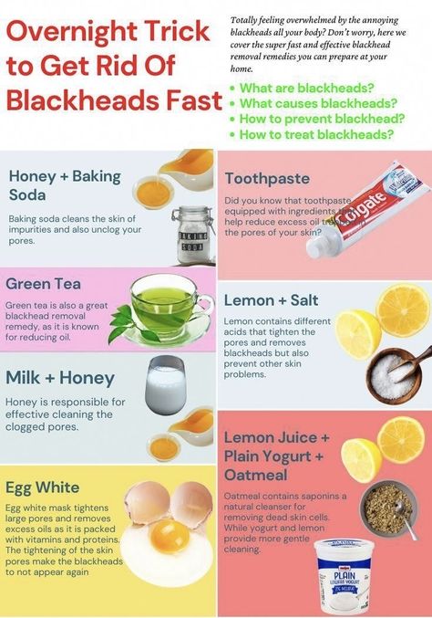 What Causes Blackheads, How To Treat Blackheads, Remedies For Blackheads, How To Prevent Blackheads, What Are Blackheads, Blackhead Remover Diy, For Blackheads, Blackhead Remedies, Green Tea Lemon