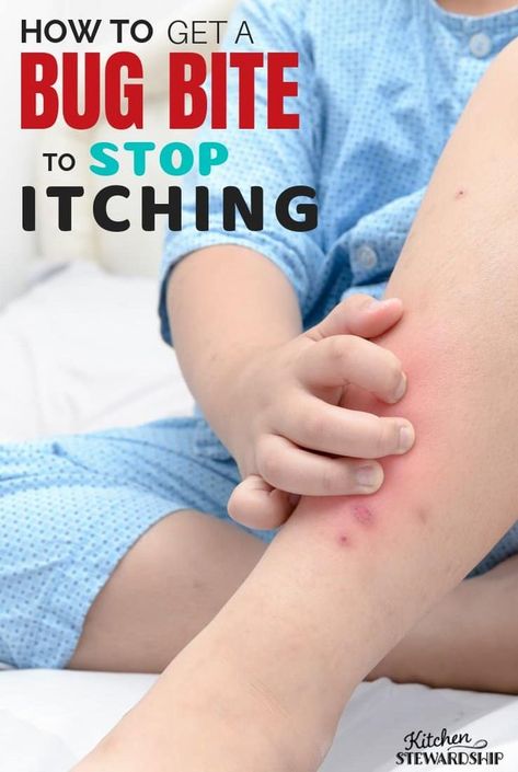 How to get a bug bite to stop itching. Calm the itch and heal quickly. Stop Bug Bites From Itching, Bite Relief, Insect Bite, Massage Pictures, Bug Bite, Are Essential Oils Safe, Massage Business, Tummy Ache, Asthma Symptoms