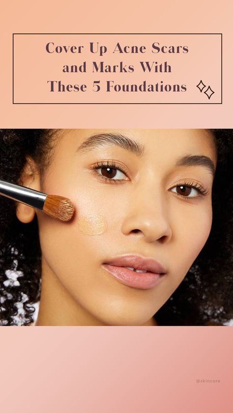 One of the worst things about breakouts is the acne scars and dark marks they can leave behind. In times like these, we tend to reach for more full coverage foundation that's great for not only concealing the hyperpigmentation but smoothing out the look of uneven textures and tones. We did some digging and found some of the best foundations that are perfect for covering up those imperfections to leave your skin looking great! #hyperpigmentation #darkmarks #acnescars #fullcoveragefoundation Makeup For Acne Scarred Skin, Best Products For Acne Scarring, Acne Scar Cover Up, Acne Scar Skin Care, Best Coverage Foundation, Cover Up Pimples, Acne Scar Hyperpigmentation, Best Foundation For Acne, Pimple Scars