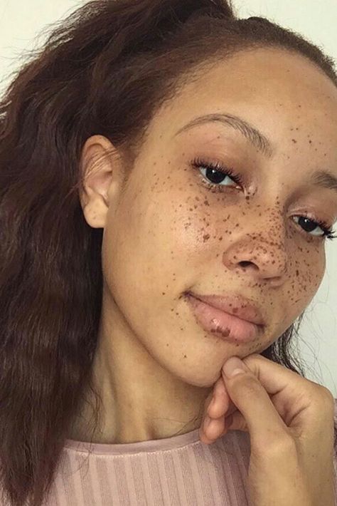 Fab and Freckled | These teeny speckled wonders look absolutely beautiful against brown skin. Freckles On Face, Black Girls With Freckles, Black Freckles, Tattooed Freckles, People With Freckles, Women With Freckles, Fake Freckles, Freckles Makeup, Beautiful Freckles