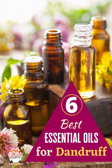 Essential Oils For Dandruff, Dandruff Essential Oil, Treat Dandruff, Natural Dandruff Remedy, Hair Oil Recipe, Diy Hair Oil, How To Treat Dandruff, Home Remedies For Dandruff, Oils For Dandruff