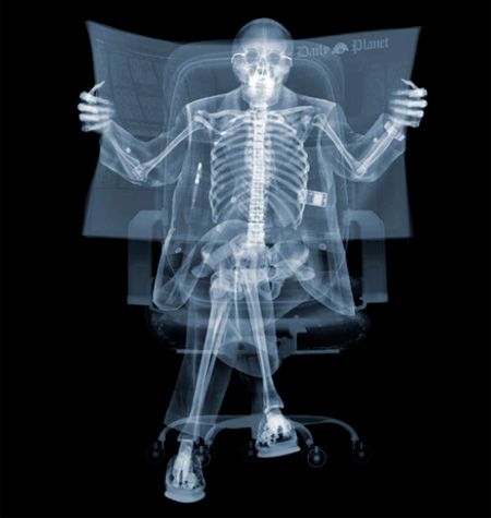 x ray photography Xray Art, X-ray Images, Blog Art, Skeleton Art, Radiology, Magazine Photography, X Ray, Stockholm, Newspaper