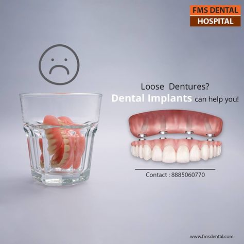 Dental Implant help your Loose Dentures. FMS INTERNATIONAL DENTAL CENTER, JUBILEE HILLS and FMS Dental Hospital, Koti, Hyderabad, are the exclusive Centers for Oral & Maxillofacial Surgery and Dental Implants. Dental Banner, Dental Campaign, Dentist Advertising, Implant Dental, Dental Post, Dental Ads, Maxillofacial Surgery, Dental Advertising, Advert Design