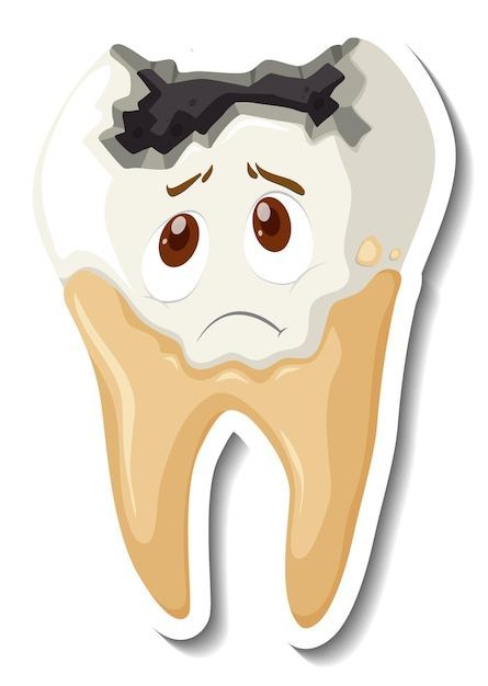 Tooth Decay Cartoon, Decayed Tooth, Teeth Decay, Tooth Caries, Cartoon Teeth, Teeth Illustration, Teeth Drawing, Tooth Cartoon, Dental Decay