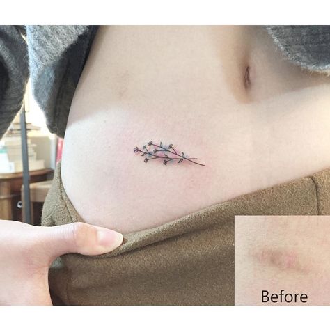 Collar Bone Tattoo Scar Cover, Hide Scar Tattoo, Tattoo Over Small Scar, Small Tattoo To Cover Scar, Simple Scar Cover Up Tattoo, Small Scar Cover Up Tattoo, Vertical Scar Tattoo Cover Up, Tattoo Ideas For Scar Cover Up, Tattoo Ideas Scar Coverups