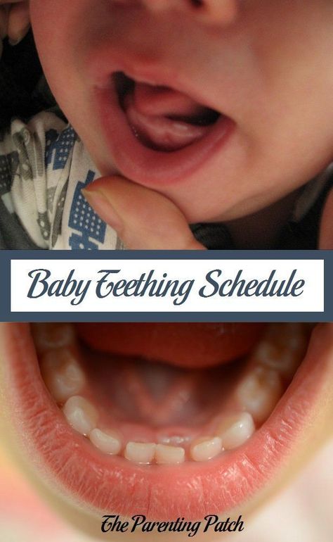 Learn about the approximate order in which primary, or baby, teeth erupt. 10 Month Milestones Baby, Teeth Eruption Chart, Baby Tooth Chart, Colic Remedies, Teething Chart, Tooth Brushing Chart, Teeth Eruption, Baby Items List, Teeth Remedies