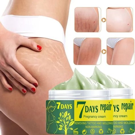 Stretch Mark Removal Cream, Marks Cream, Stretch Mark Cream, Stretch Mark Removal, Acne Scar, Body Creams, Stretch Mark, Perfect Skin Care Routine, روتين العناية بالبشرة