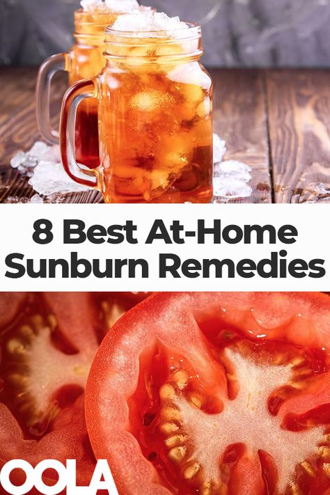 Sunburn Remedies: 8 of the Best At-Home Treatments - Oola.com Sunburn Home Remedies, Sore Gums Remedy, Best Remedy For Sunburn, Home Remedies For Sunburn, Sunburn Remedies, Skin Natural Remedies, Healthier Choices, Home Health Remedies, Skin Lotion